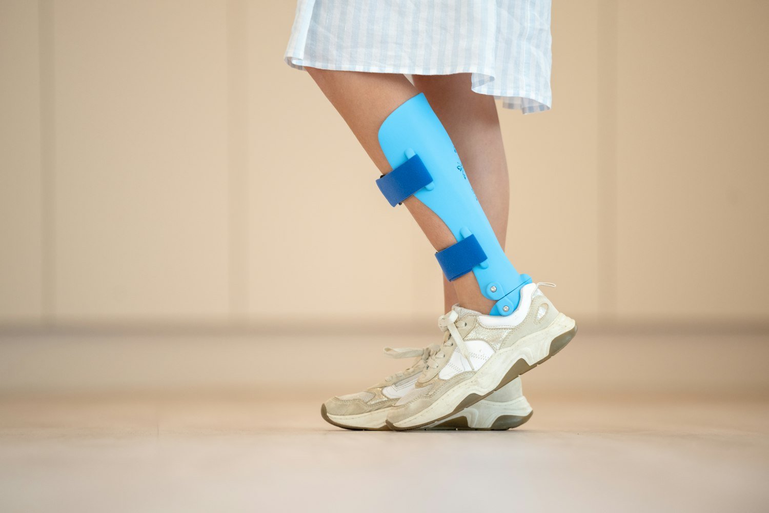 A person with a cast on their leg, the kind of injury that alters gait and strains the other side